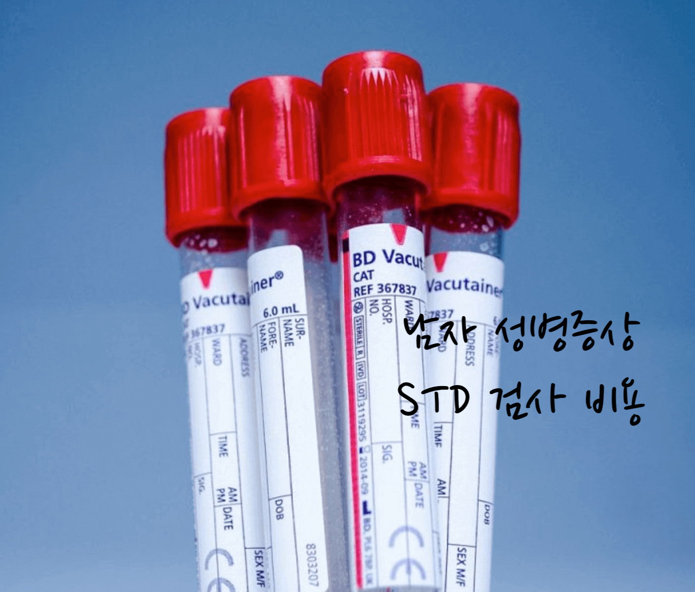 남자 성병증상 STD 검사 비용