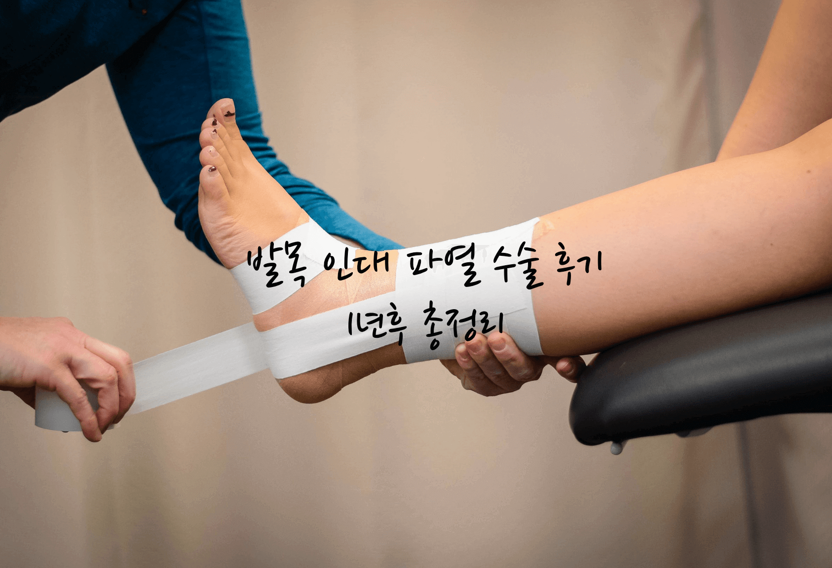 발목 인대 파열 수술 후기 1년후 총정리