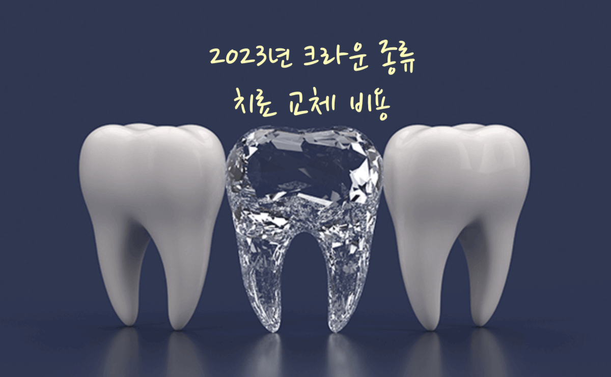치아 크라운 종류 치료 교체 비용 2023