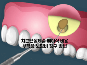 치근단절제술 뼈이식 비용 부작용 보험비 청구 방법